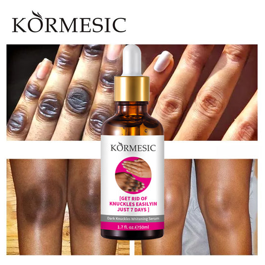 KORMESIC – sérum blanchissant contre les quintos